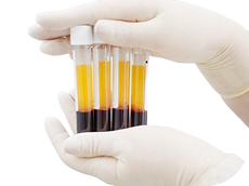 VINDECARE ACCELERATĂ PRF